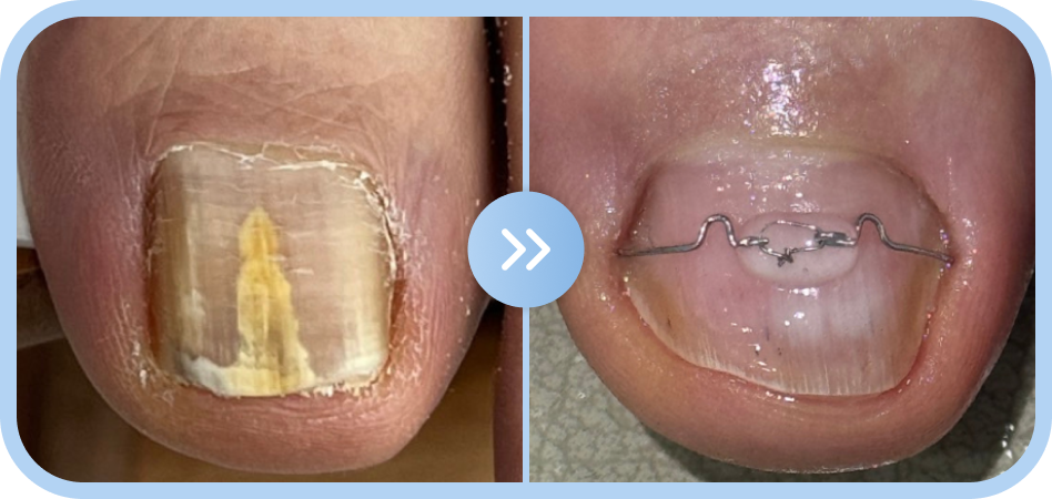 약 6개월 관리과정