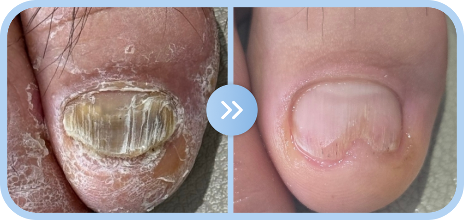 복원 전 > 복원 후